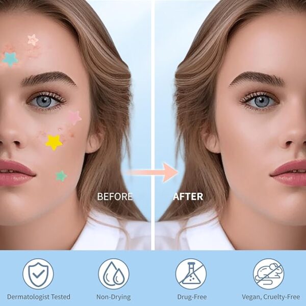 Pimple Patches for Face, Hydrocolloid Acne Patches, Cute Star Zit Covers - Image 3