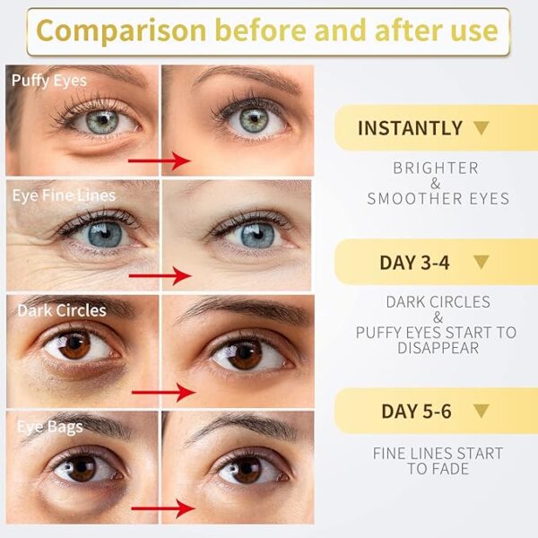 Under Eye Patches - 30 Pairs - 24K Gold Eye Mask- Puffy Eyes & Dark Circles Treatments,Reduce Under Eye Bags and Smooth Wrinkles,Eye Skin Care Pads With Collagen - Image 3